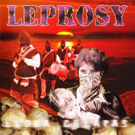 CD Leprosy – Llora Chiapas