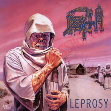 CD Death - Leprosy