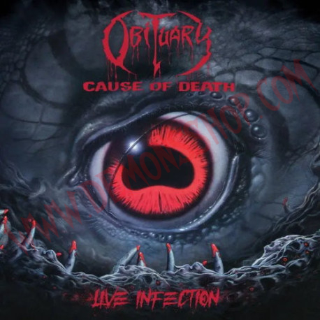 CD Obituary - Cause Of Death - Live Infection